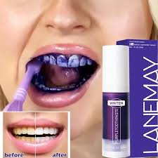 Hi Smile Teeth Whitening